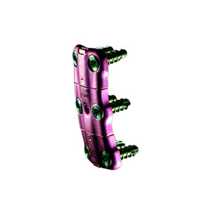 Spinal Simplicity Announces FDA Clearance of Its Wolff's Law Anterior Cervical Plate System